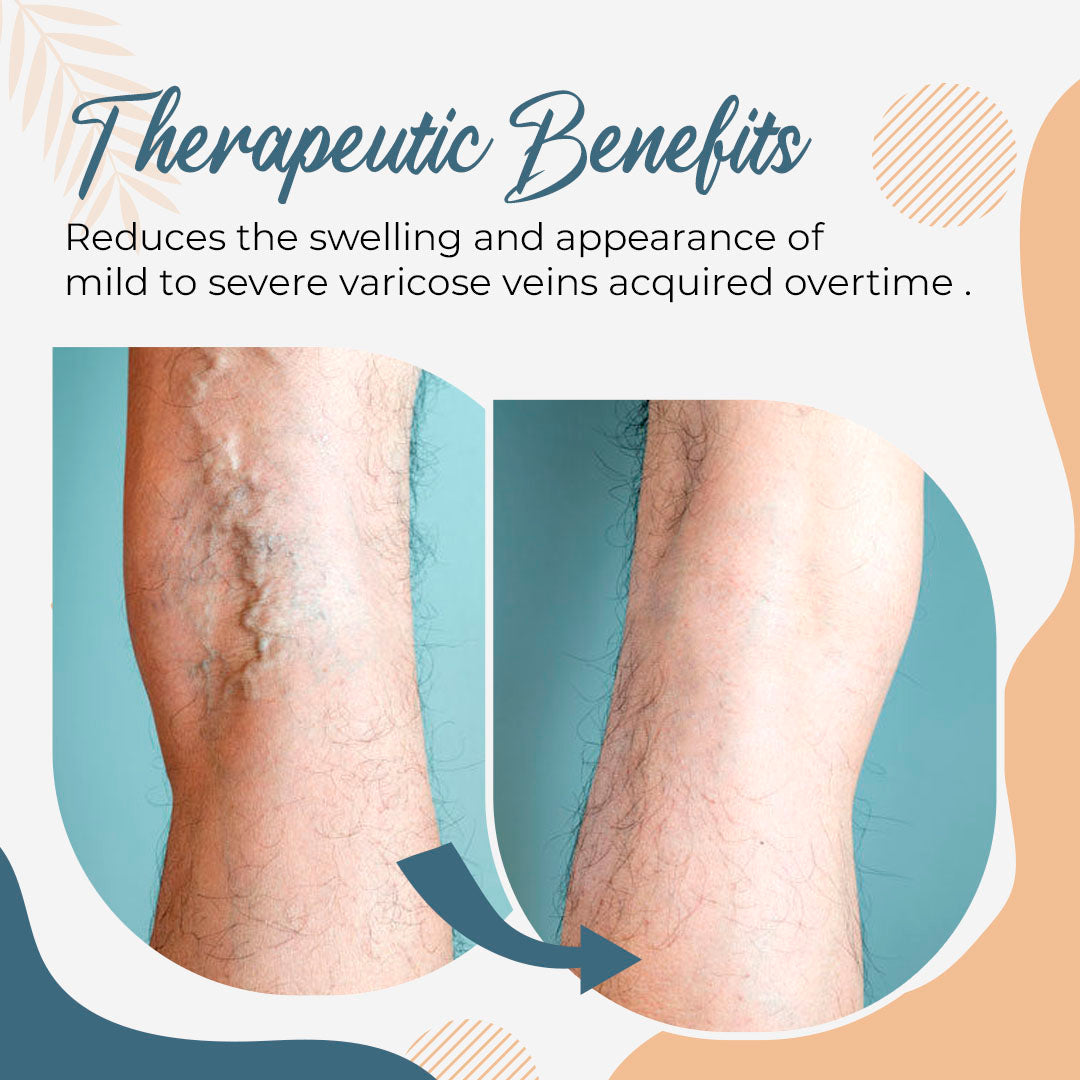 Varicose Veins Care Foot Patch
