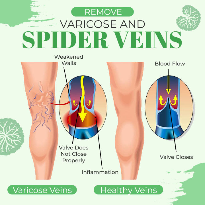 VeinoPro Varicose-Veins Treatment Soap