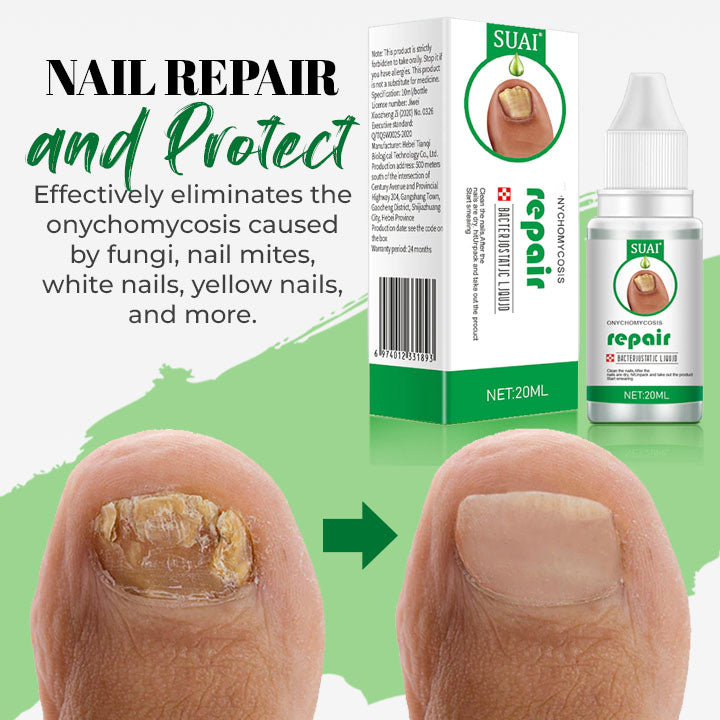 Fungal Nail Treatment Essential Oil