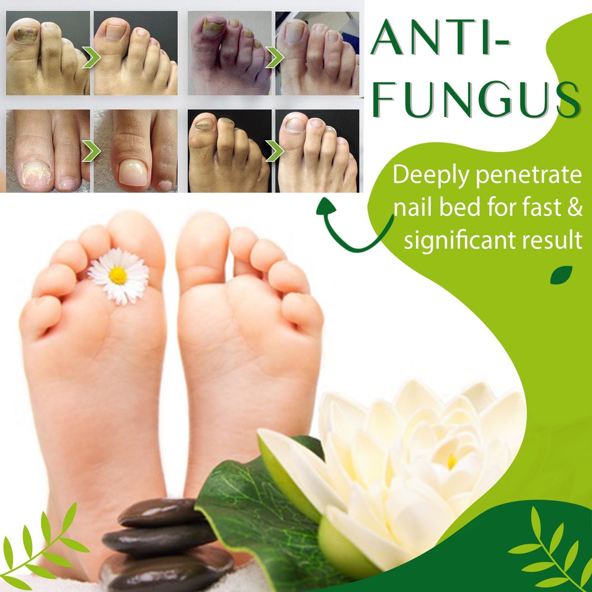 Anti-fungal Herbal Foot Soak